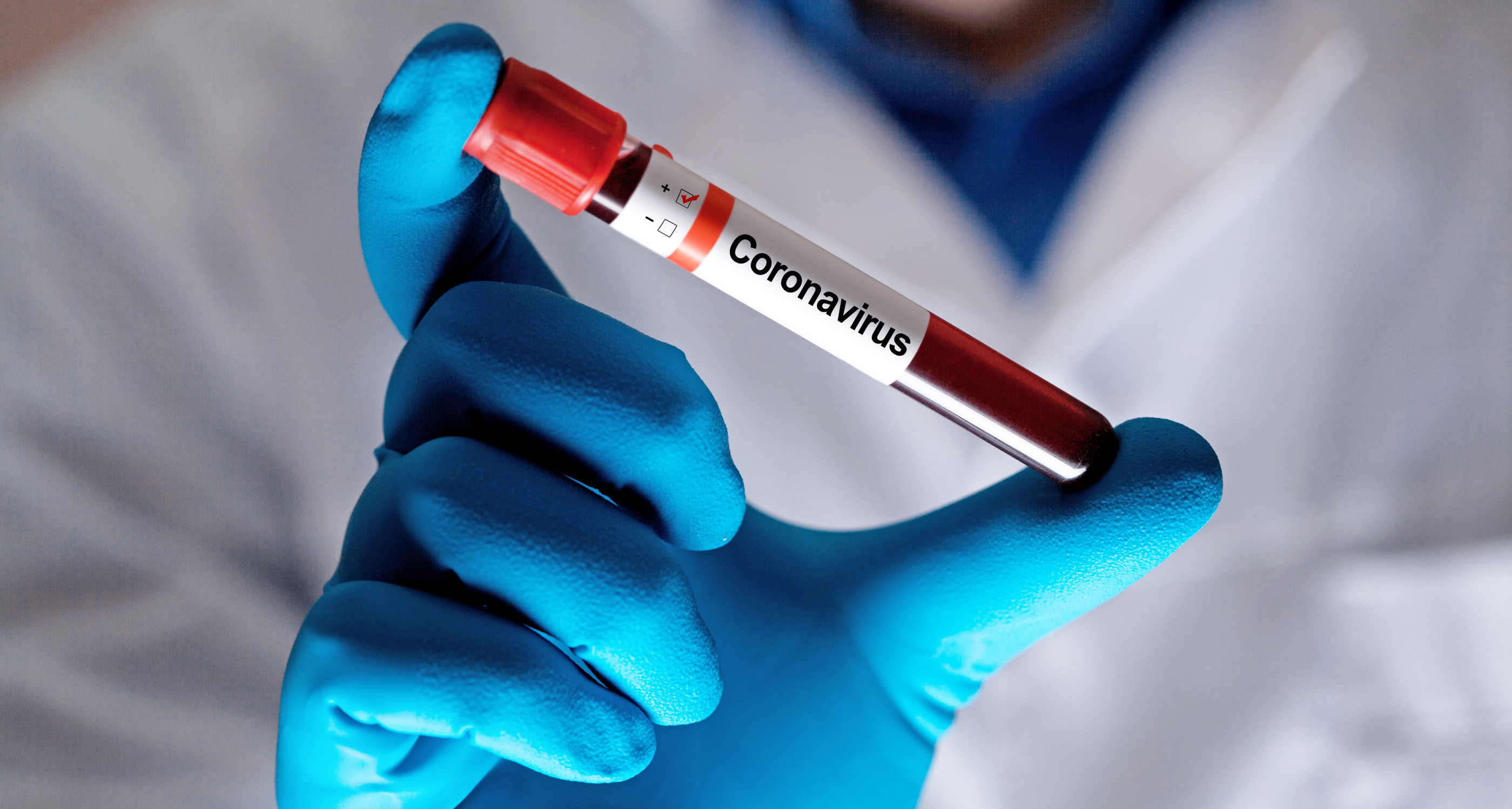 Corona-Virus-Epidemie